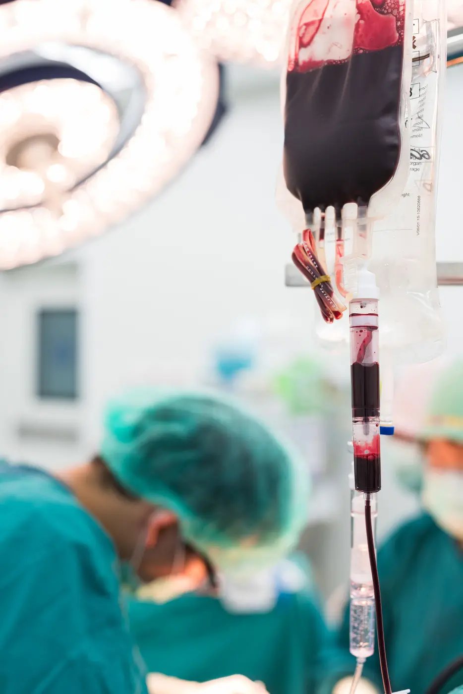 Unidad de sangre en transfusión durante un procedimiento quirúrgico